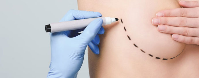 Best Skin Sparing & Nipple Sparing in Dombivli